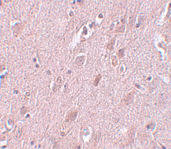 a16432 zc3h12b primary antibodies ihc testing 2