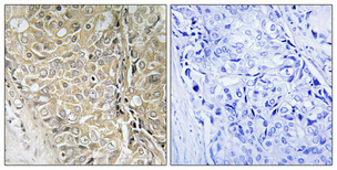 a16435 1 tpd52l3 primary antibodies ihc testing 1