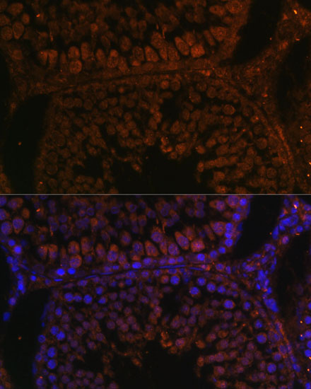 a16435 tpd52l3 primary antiboties if testing 2