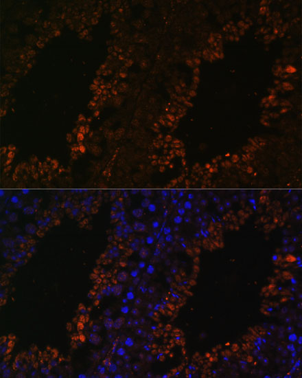 a16435 tpd52l3 primary antiboties if testing 3