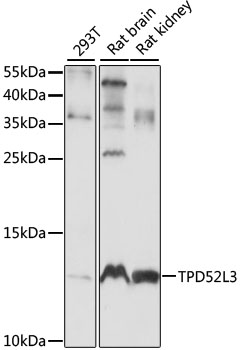 a16435 tpd52l3 primary antiboties wb testing 1