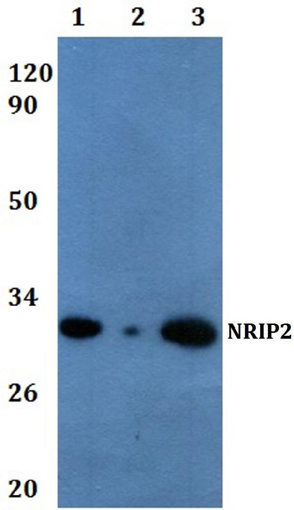 a16445 1 nrip2 primary antiboties wb testing 1