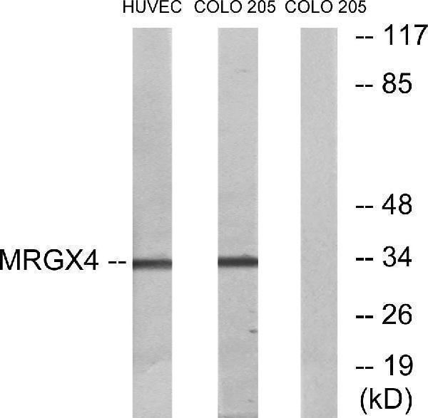 Western blot analysis of lysates from HUVEC and COLO cells, using MRGX4 Antibody