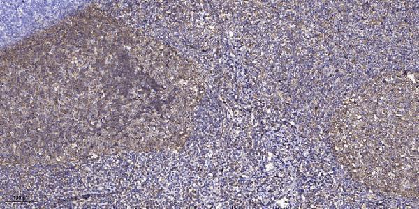 a16463 1 znf600 primary antibodies ihc testing 1