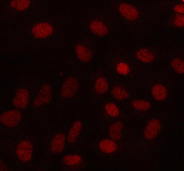 Figure 2. IF analysis of MAMDC4 using anti-MAMDC4 antibody (A16484). MAMDC4 was detected in an immunocytochemical section of A549 cells. Enzyme antigen retrieval was performed using IHC enzyme antigen retrieval reagent (AR0022) for 15 mins. The cells were blocked with 10% goat serum. And then incubated with 5 microg/mL rabbit anti-MAMDC4 Antibody (A16484) overnight at 4°C. Cy3 Conjugated Goat Anti-Rabbit IgG (BA1032) was used as secondary antibody at 1:500 dilution and incubated for 30 minutes at 37°C. Visualize using a fluorescence microscope and filter sets appropriate for the label used.
