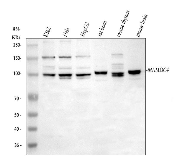 Figure 1. Western blot analysis of MAMDC4 using anti-MAMDC4 antibody (A16484). Electrophoresis was performed on a 5-20% SDS-PAGE gel at 70V (Stacking gel) / 90V (Resolving gel) for 2-3 hours. The sample well of each lane was loaded with 30 ug of sample under reducing conditions. Lane 1: human K562 whole cell lysates, Lane 2: human Hela whole cell lysates, Lane 3: human HepG2 whole cell lysates, Lane 4: rat brain tissue lysates, Lane 5: mouse thymus tissue lysates, Lane 6: mouse brain tissue lysates. After electrophoresis, proteins were transferred to a nitrocellulose membrane at 150 mA for 50-90 minutes. Blocked the membrane with 5% non-fat milk/TBS for 1.5 hour at RT. The membrane was incubated with rabbit anti-MAMDC4 antigen affinity purified polyclonal antibody (Catalog # A16484) at 0.5 microg/mL overnight at 4°C, then washed with TBS-0.1%Tween 3 times with 5 minutes each and probed with a goat anti-rabbit IgG-HRP secondary antibody at a dilution of 1:5000 for 1.5 hour at RT. The signal is developed using an Enhanced Chemiluminescent detection (ECL) kit (Catalog # EK1002) with Tanon 5200 system. A specific band was detected for MAMDC4 at approximately 100 kDa. The expected band size for MAMDC4 is at 131 kDa.