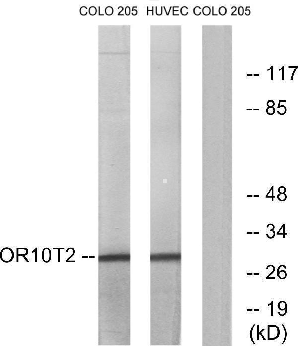 Western blot analysis of lysates from HUVEC and COLO cells, using OR10T2 Antibody