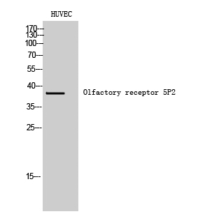 Western Blot analysis of HUVEC cells using Olfactory receptor 5P2 Polyclonal Antibody