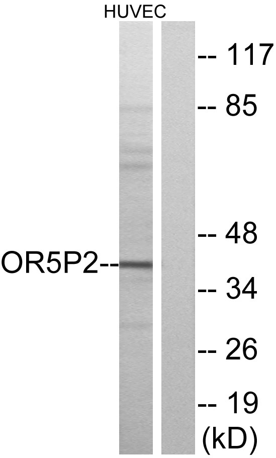 Western blot analysis of lysates from HUVEC cells, using OR5P2 Antibody