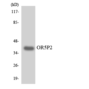 Western blot analysis of the lysates from K562 cells using OR5P2 antibody