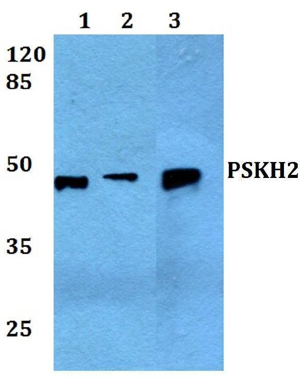 a16538 pskh2 primary antiboties wb testing 1