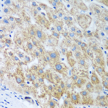 Immunohistochemistry of paraffin-embedded human liver using UBE2U antibody  at dilution of 1:100 