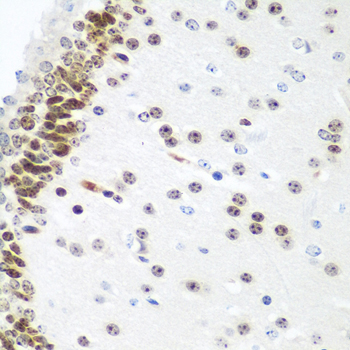 Immunohistochemistry of paraffin-embedded mouse brain using UBE2U antibody  at dilution of 1:100 