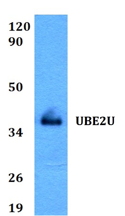 Western blot (WB) analysis of UBE2U polyclonal antibody at 1:500 dilution
Lane1:HEK293T whole cell lysate