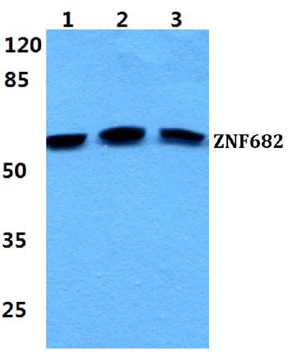 Western blot (WB) analysis of ZNF682 polyclonal antibody at 1:500 dilution
Lane1:HEK293T cell lysate
Lane2:NIH-3T3 cell lysate
Lane3:H9C2 cell lysate