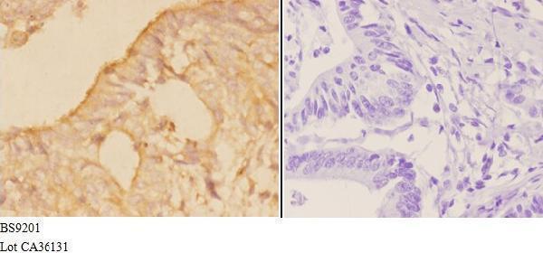 a16547t121 potekp primary antiboties ihc testing 2