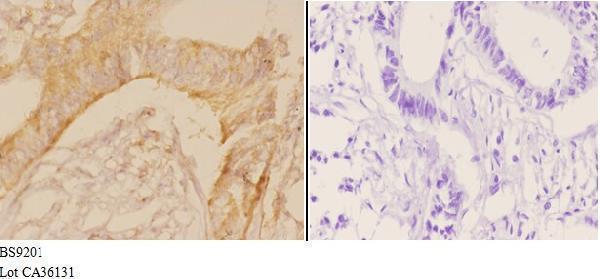 a16547t121 potekp primary antiboties ihc testing 3