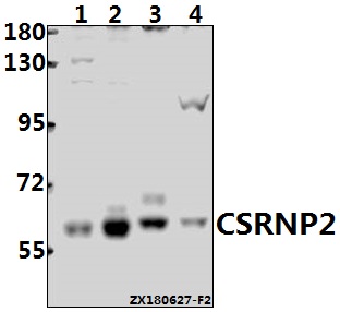 Western blot (WB) analysis of CSRNP2 (K127) pAb at 1:1000 dilution
Lane1:HCT116 whole cell lysate(40ug)
Lane2:H1792 whole cell lysate(40ug)
Lane3:CT26 whole cell lysate(40ug)
Lane4:H9C2 whole cell lysate(40ug)