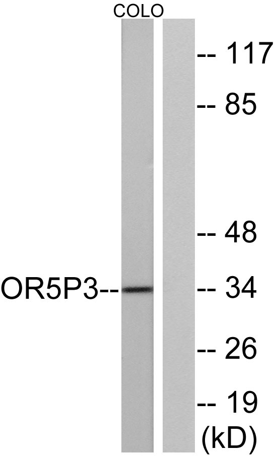 Western blot analysis of lysates from COLO cells, using OR5P3 Antibody