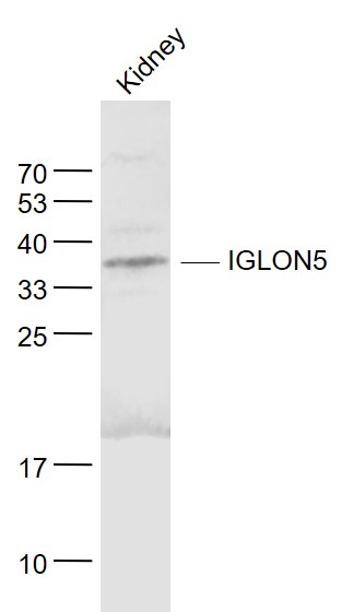 Western blot (WB) analysis of IGLON5 polyclonal antibody at 1:1000 dilution
Lane1:BV2 whole cell lysate(40ug)
Lane2:A2780 whole cell lysate(40ug)
Lane3:EC9706 whole cell lysate(40ug)
Lane4:C6 whole cell lysate(20ug)
Lane5:U-87MG whole cell lysate(30ug)