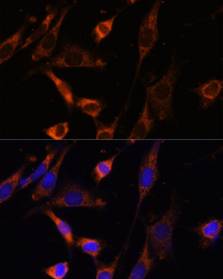 a16590 1 ckmt1a primary antiboties if testing 2
