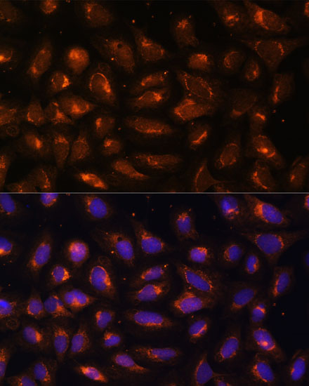 a16590 1 ckmt1a primary antiboties if testing 3