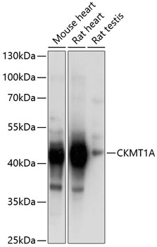 Western blot analysis of extracts of various cell lines, using CKMT1A Antibody  at 1:1000 dilution