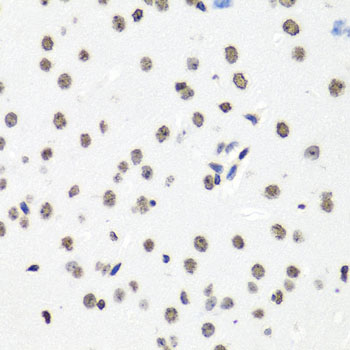 a16595 1 hist1h2bc primary antiboties ihc testing 2