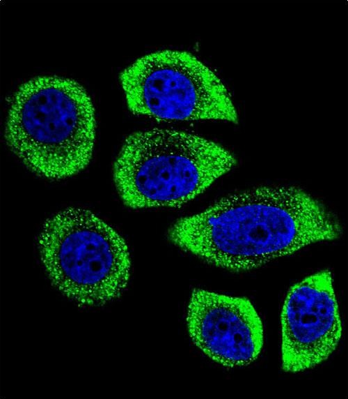 a16602 1 anti pip5kl1 antibody n term if testing 1
