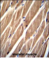 a16602 1 anti pip5kl1 antibody n term ihc p testing 3