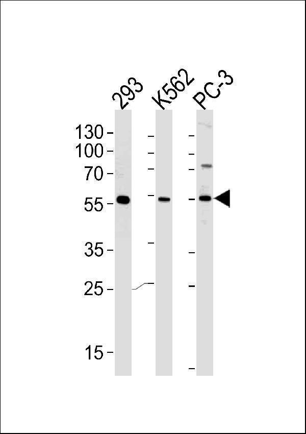 a16602 1 anti pip5kl1 antibody n term wb testing 2