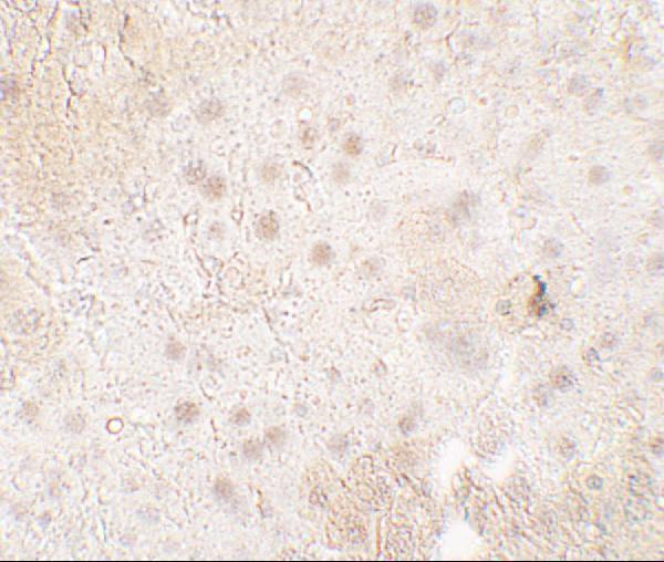 a16616 tmigd1 primary antibodies ihc testing 2