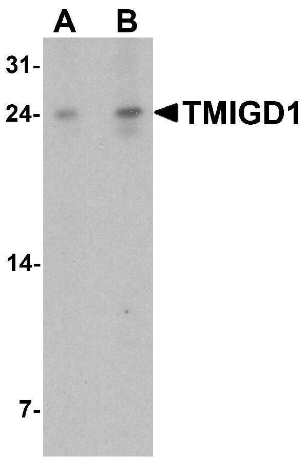 a16616 tmigd1 primary antibodies wb testing 1