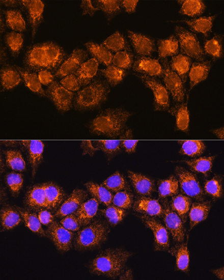 Immunofluorescence analysis of HeLa cells using RABL3 Rabbit pAb  at dilution of 1:100
