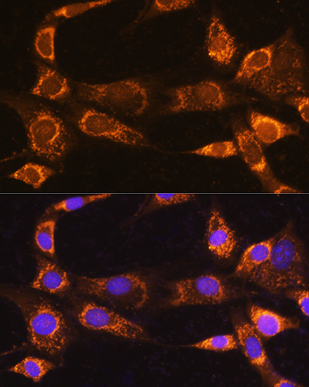 Immunofluorescence analysis of NIH/3T3 cells using RABL3 Rabbit pAb  at dilution of 1:100