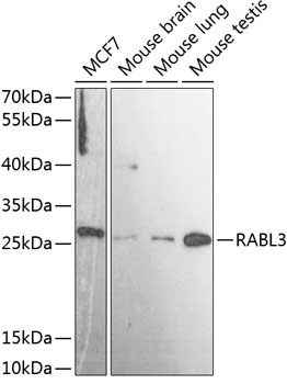Western blot analysis of extracts of various cell lines, using RABL3 antibody  at 1:3000 dilution