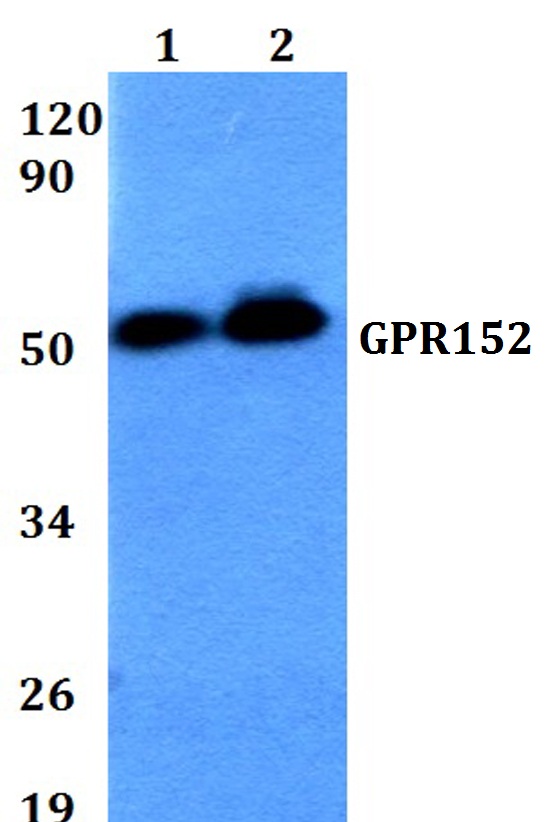 Western blot (WB) analysis of GPR152 polyclonal antibody at 1:500 dilution
Lane1:HEK293T whole cell lysate
Lane2:Raw264