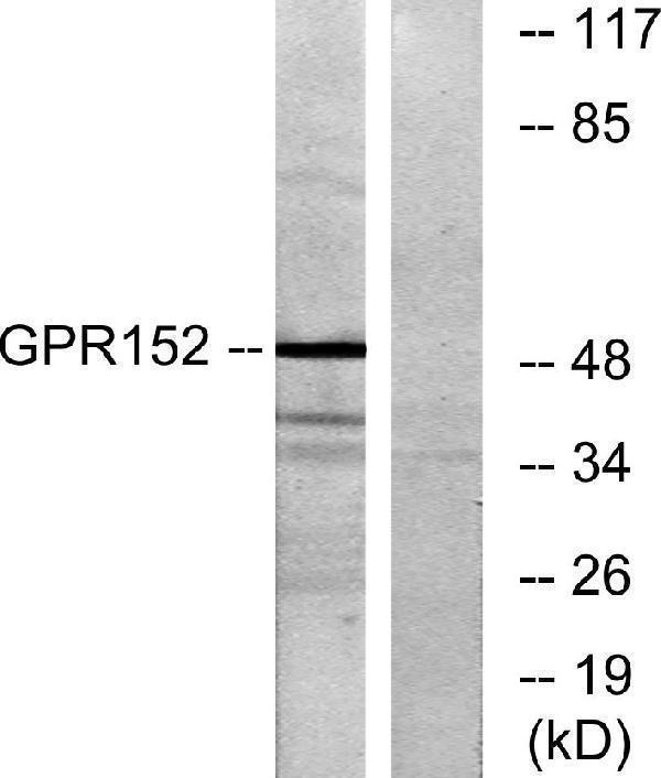 a16638 gpr152 primary antibodies wb testing 1