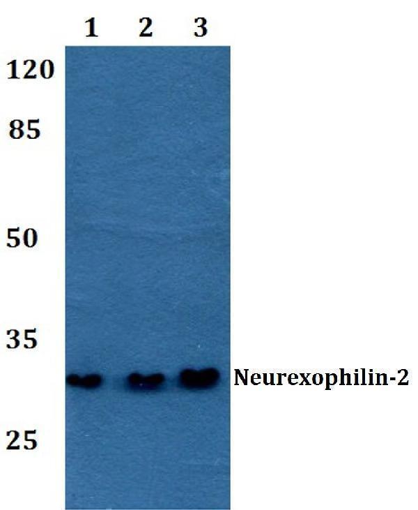 Western blot (WB) analysis of Neurexophilin-2 polyclonal antibody at 1:500 dilution
Lane1:HEK293T whole cell lysate
Lane2:Mouse brain tissue lysate
Lane3:Rat brain tissue lysate