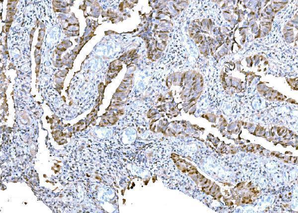  IHC analysis of DPY19L1 using anti-DPY19L1 antibody (A16659-1)