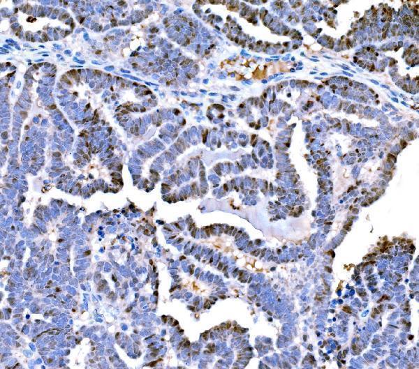  IHC analysis of DPY19L1 using anti-DPY19L1 antibody (A16659-1)