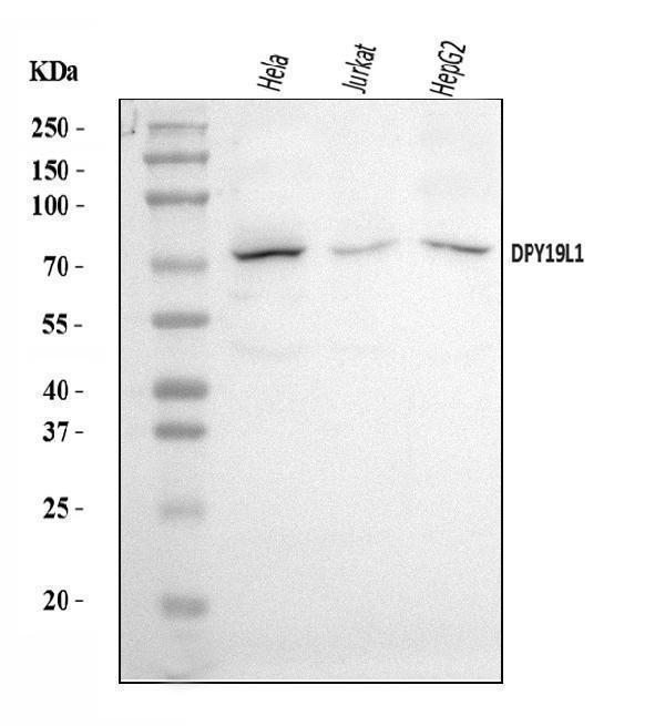  Western blot analysis of DPY19L1 using anti-DPY19L1 antibody (A16659-1)
