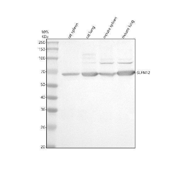 Western blot analysis of SLFN12 using anti-SLFN12 antibody (A16669-1)