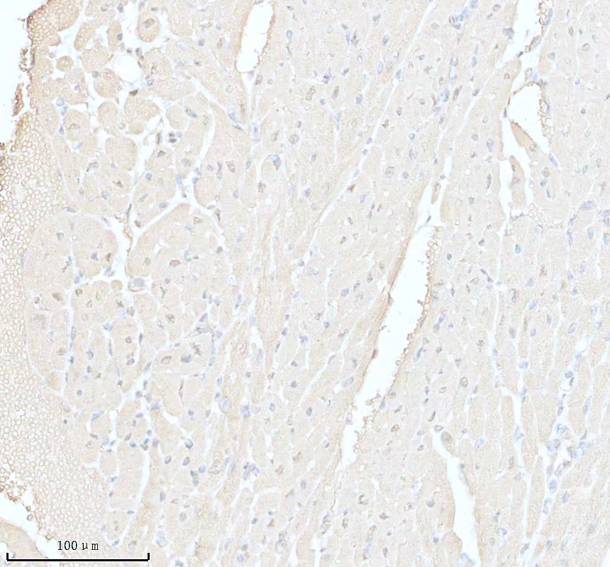 IHC analysis of LRRC2 using anti-LRRC2 antibody (A16692-1)
