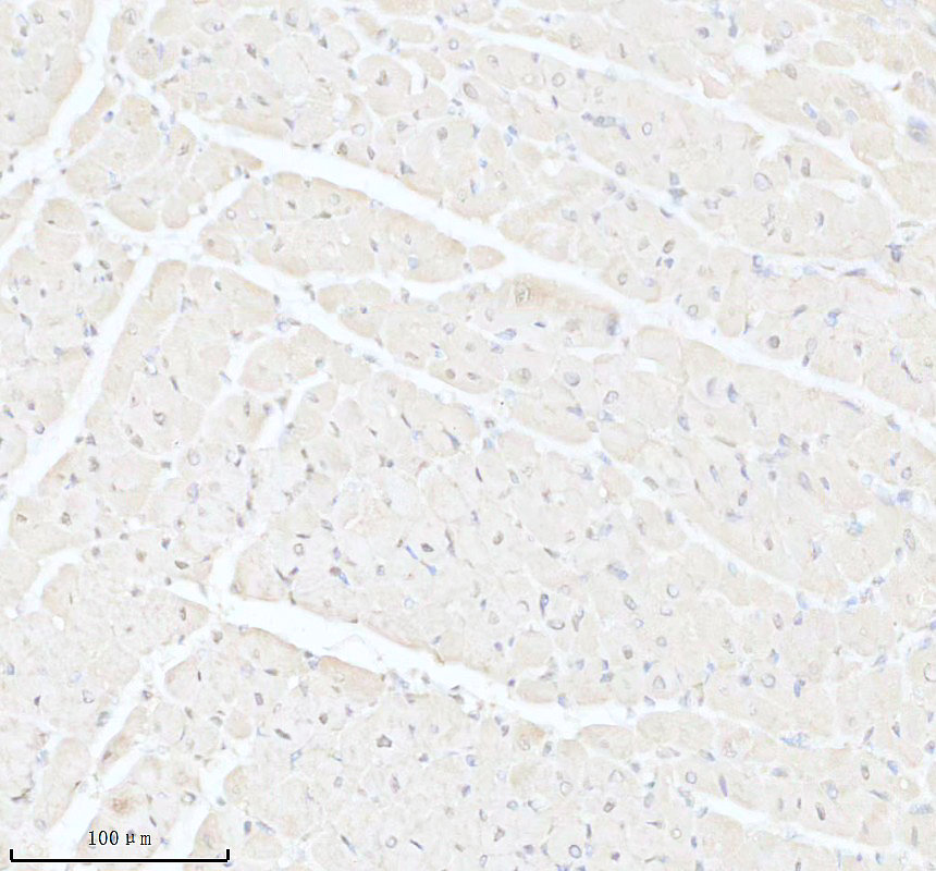 IHC analysis of LRRC2 using anti-LRRC2 antibody (A16692-1)