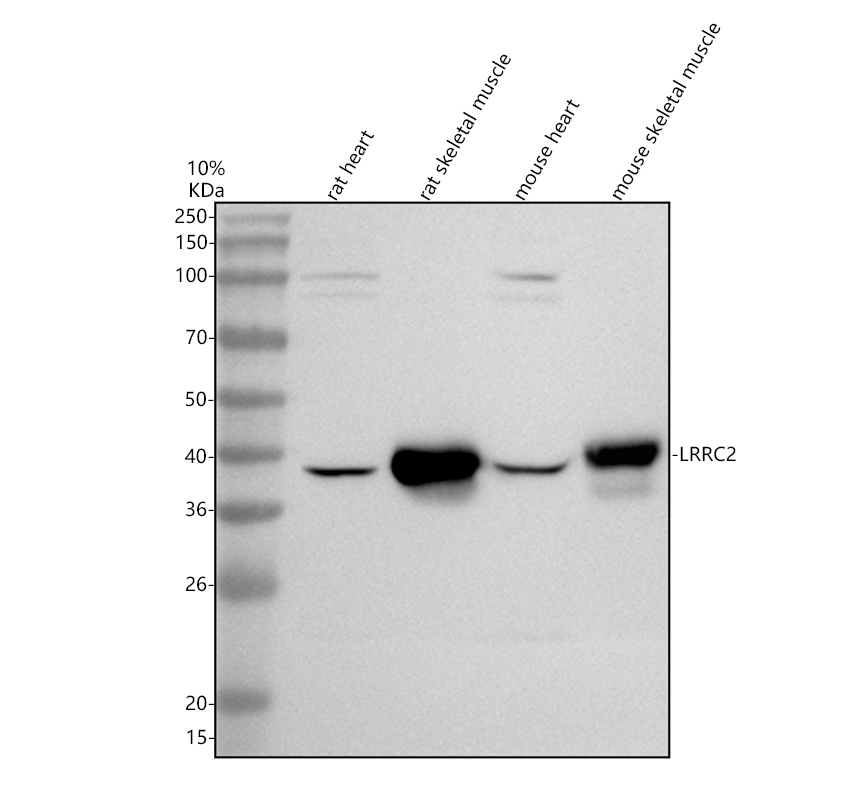 Western blot analysis of LRRC2 using anti-LRRC2 antibody (A16692-1)