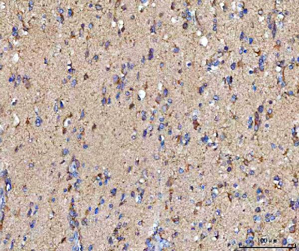 Figure 2. IHC analysis of MOSPD2 using anti-MOSPD2 antibody (A16695-1). MOSPD2 was detected in a paraffin-embedded section of human brain tissue. Heat mediated antigen retrieval was performed in EDTA buffer (pH 8.0, epitope retrieval solution). The tissue section was blocked with 10% goat serum. The tissue section was then incubated with 2 microg/ml rabbit anti-MOSPD2 Antibody (A16695-1) overnight at 4°C. Peroxidase Conjugated Goat Anti-rabbit IgG was used as secondary antibody and incubated for 30 minutes at 37°C. The tissue section was developed using HRP Conjugated Rabbit IgG Super Vision Assay Kit (Catalog # SV0002) with DAB as the chromogen. Figure 2. IHC analysis of MOSPD2 using anti-MOSPD2 antibody (A16695-1). MOSPD2 was detected in a paraffin-embedded section of human brain tissue. Heat mediated antigen retrieval was performed in EDTA buffer (pH 8.0, epitope retrieval solution). The tissue section was blocked with 10% goat serum. The tissue section was then incubated with 2 microg/ml rabbit anti-MOSPD2 Antibody (A16695-1) overnight at 4°C. Peroxidase Conjugated Goat Anti-rabbit IgG was used as secondary antibody and incubated for 30 minutes at 37°C. The tissue section was developed using HRP Conjugated Rabbit IgG Super Vision Assay Kit (Catalog # SV0002) with DAB as the chromogen.