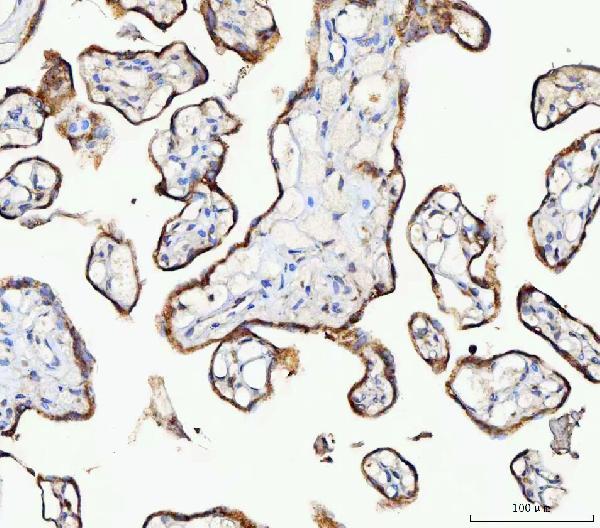 Figure 4. IHC analysis of MOSPD2 using anti-MOSPD2 antibody (A16695-1). MOSPD2 was detected in a paraffin-embedded section of human placenta tissue. Heat mediated antigen retrieval was performed in EDTA buffer (pH 8.0, epitope retrieval solution). The tissue section was blocked with 10% goat serum. The tissue section was then incubated with 2 microg/ml rabbit anti-MOSPD2 Antibody (A16695-1) overnight at 4°C. Peroxidase Conjugated Goat Anti-rabbit IgG was used as secondary antibody and incubated for 30 minutes at 37°C. The tissue section was developed using HRP Conjugated Rabbit IgG Super Vision Assay Kit (Catalog # SV0002) with DAB as the chromogen. Figure 4. IHC analysis of MOSPD2 using anti-MOSPD2 antibody (A16695-1). MOSPD2 was detected in a paraffin-embedded section of human placenta tissue. Heat mediated antigen retrieval was performed in EDTA buffer (pH 8.0, epitope retrieval solution). The tissue section was blocked with 10% goat serum. The tissue section was then incubated with 2 microg/ml rabbit anti-MOSPD2 Antibody (A16695-1) overnight at 4°C. Peroxidase Conjugated Goat Anti-rabbit IgG was used as secondary antibody and incubated for 30 minutes at 37°C. The tissue section was developed using HRP Conjugated Rabbit IgG Super Vision Assay Kit (Catalog # SV0002) with DAB as the chromogen.