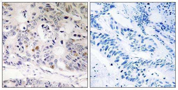 a16697 1 ubtd1 primary antibodies ihc testing 1