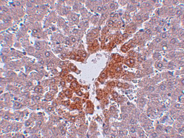 a16698 jmjd7 primary antibodies ihc testing 2